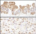 VCP Polyclonal Antibody