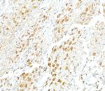 VCP Polyclonal Antibody