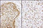 Matrin 3 Polyclonal Antibody