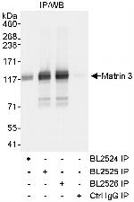 Matrin 3 Antibody in Immunoprecipitation (IP)