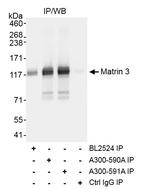 Matrin 3 Antibody in Immunoprecipitation (IP)