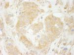 Sec23IP/MSTP053 Polyclonal Antibody