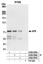 AF9 Antibody in Immunoprecipitation (IP)