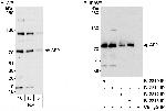 AF9 Antibody in Western Blot (WB)