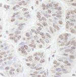 GNL3 Polyclonal Antibody