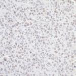 GNL3 Polyclonal Antibody