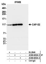 CAP-G2 Antibody in Immunoprecipitation (IP)