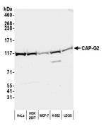 CAP-G2 Antibody in Western Blot (WB)