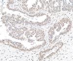 BTF Polyclonal Antibody
