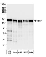 BTF Antibody in Western Blot (WB)