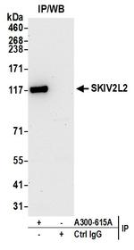 SKIV2L2 Polyclonal Antibody