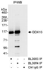 DDX10 Polyclonal Antibody