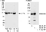 DDX10 Polyclonal Antibody