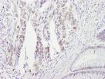Chk2 Antibody in Immunohistochemistry (Paraffin) (IHC (P))