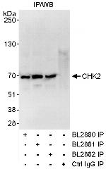 Chk2 Antibody in Immunoprecipitation (IP)