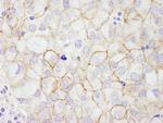 ErbB2 Antibody in Immunohistochemistry (Paraffin) (IHC (P))