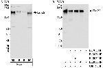 ErbB2 Antibody in Western Blot (WB)