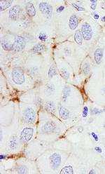 ErbB2 Antibody in Immunohistochemistry (Paraffin) (IHC (P))