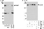 ErbB2 Antibody in Western Blot (WB)