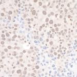 DHX8 Polyclonal Antibody