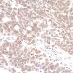 DHX8 Antibody in Immunohistochemistry (Paraffin) (IHC (P))