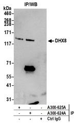 DHX8 Antibody in Immunoprecipitation (IP)