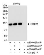 DDX21 Antibody in Immunoprecipitation (IP)
