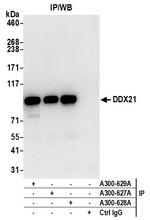 DDX21 Antibody in Immunoprecipitation (IP)