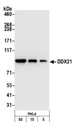 DDX21 Antibody in Western Blot (WB)