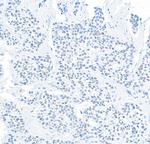 DEC1 Polyclonal Antibody