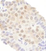 DDX20 Polyclonal Antibody