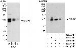 DDX20 Antibody in Western Blot (WB)