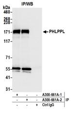 PHLPPL Antibody in Immunoprecipitation (IP)