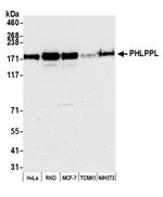 PHLPPL Polyclonal Antibody
