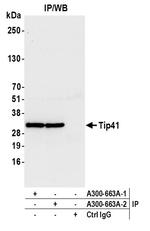 Tip41 Antibody in Immunoprecipitation (IP)