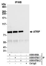 ATRIP Antibody in Immunoprecipitation (IP)