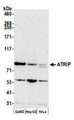 ATRIP Antibody in Western Blot (WB)