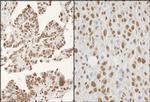 hnRNP-K Polyclonal Antibody