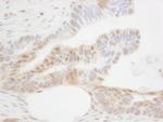 CDX2 Antibody in Immunohistochemistry (Paraffin) (IHC (P))