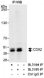 CDX2 Antibody in Immunoprecipitation (IP)