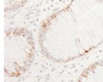 CDX2 Antibody in Immunohistochemistry (Paraffin) (IHC (P))