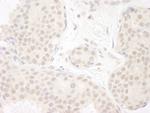 DDX23 Antibody in Immunohistochemistry (Paraffin) (IHC (P))