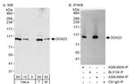 DDX23 Antibody in Western Blot (WB)