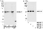 DDX24 Polyclonal Antibody
