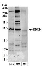 DDX24 Polyclonal Antibody