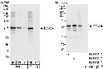 DDX24 Antibody in Western Blot (WB)