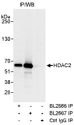 HDAC2 Polyclonal Antibody