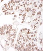 HDAC2 Polyclonal Antibody