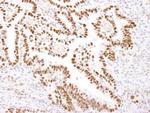 Nucleolin/NCL Polyclonal Antibody