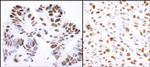Nucleolin/NCL Polyclonal Antibody